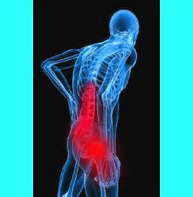 what is sciatic pain?